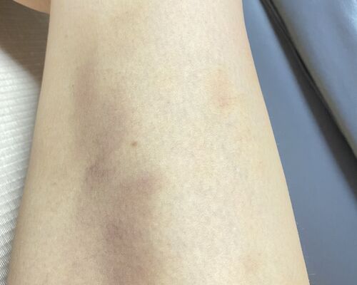 F514BD72-EEE3-4969-A04B-C88D1185A1B1